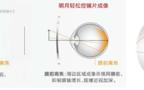 明月镜片的炸裂业绩，靠什么驱动？